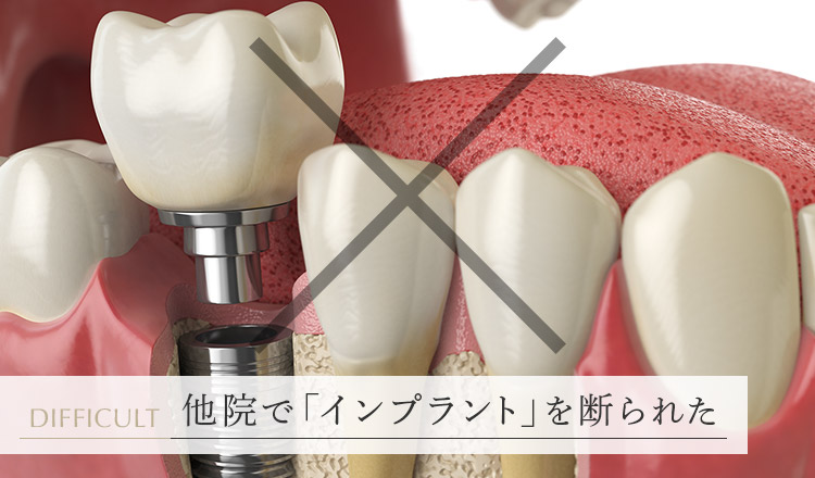 東京・港区で他院で「インプラント」を断られた方へ｜高村歯科医院